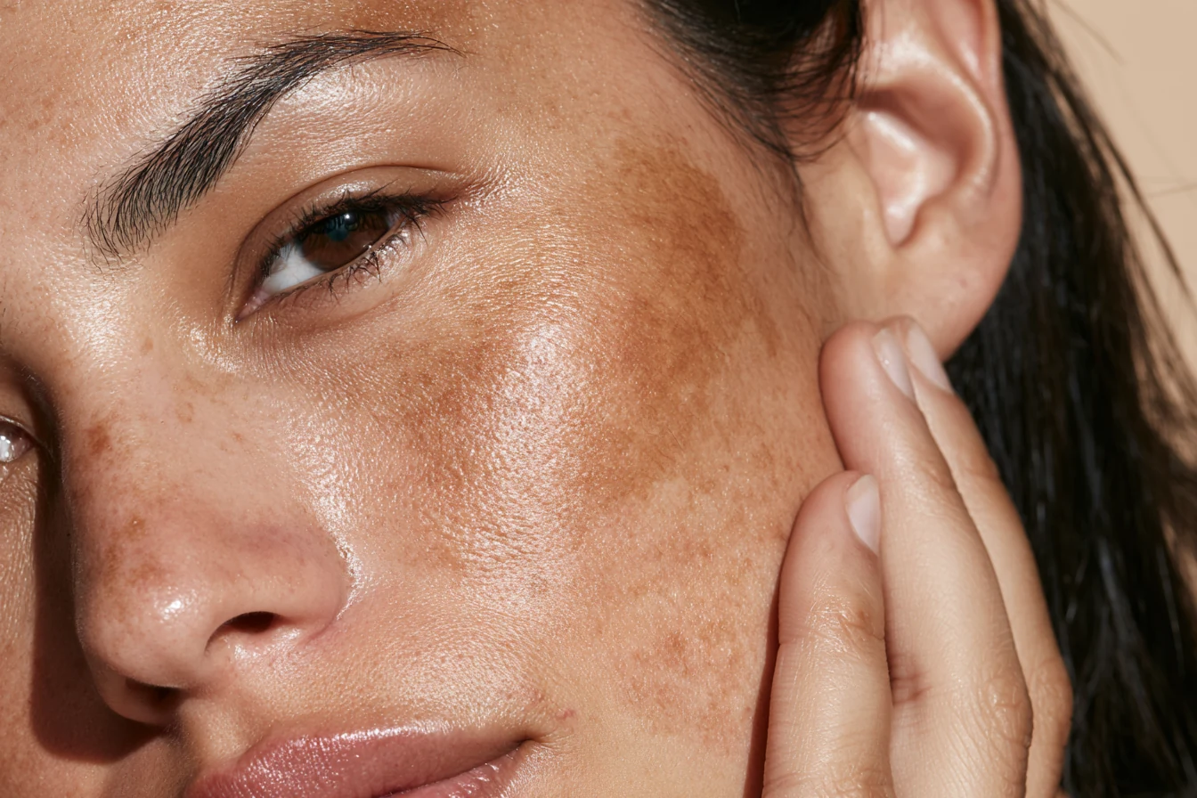 objective dark spots tone